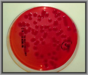 petri dish showing waterborne pathogen legionella Blue Earth Products The Science of Safe Water