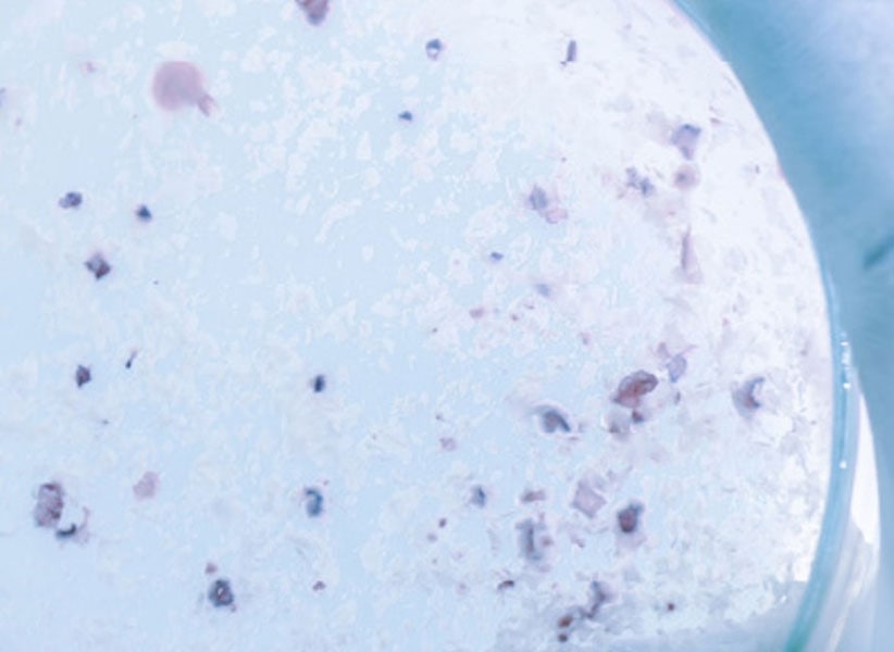 Hero Legionella Services Bacteria Close Up Blue Earth Products