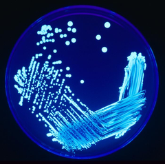 legionella in a petri dish Blue Earth Products The Science of Safe Water
