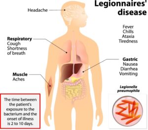 graphic of how legionnaires disease affects the human body Blue Earth Products The Science of Safe Water